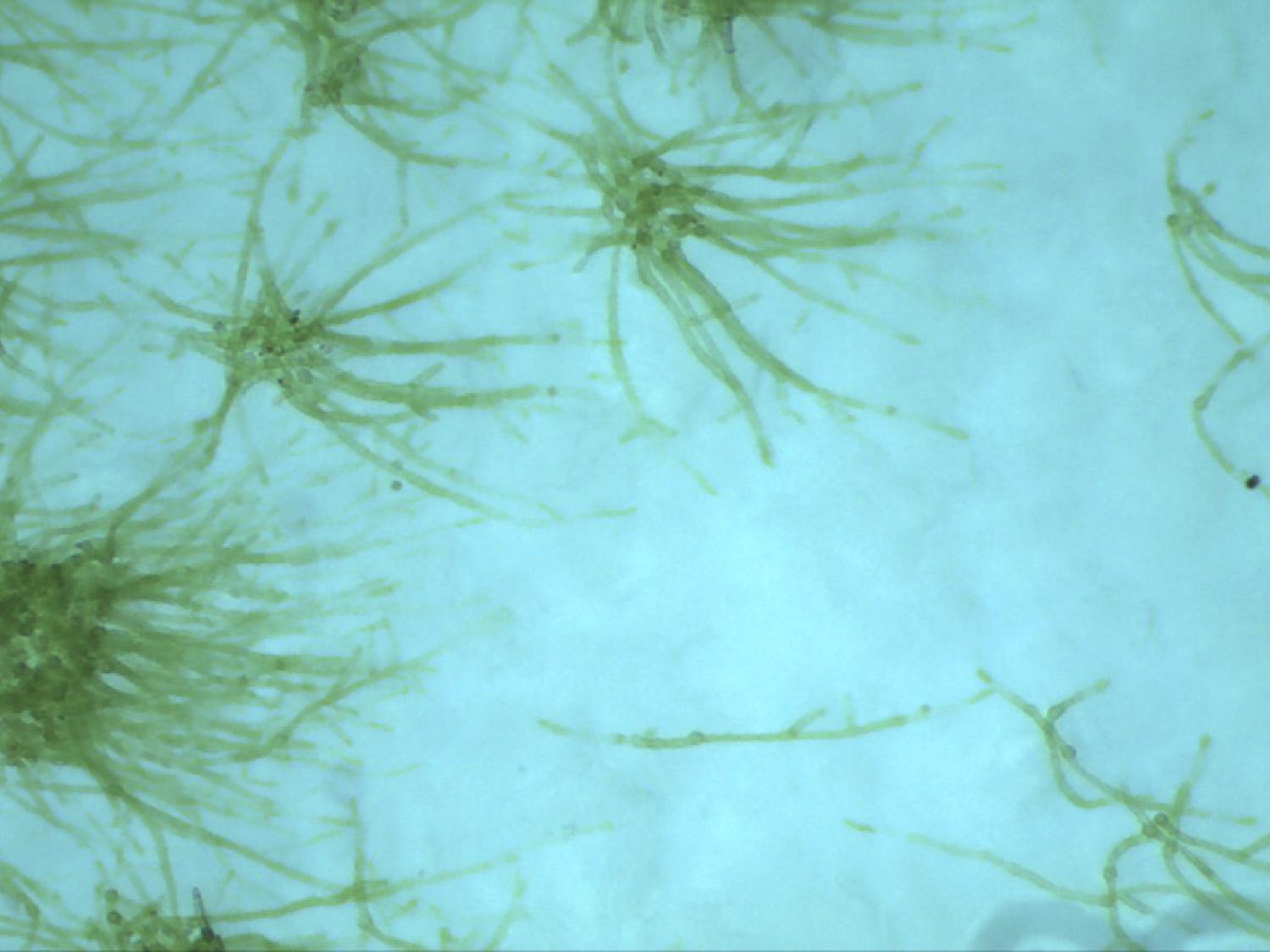 苔の基本特性について２